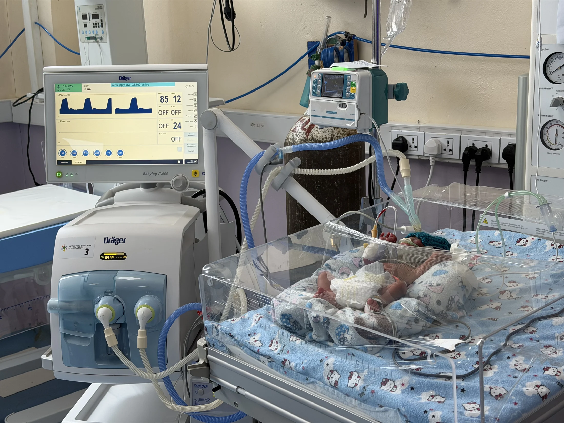 Newborn care equipment and bedside monitors in Hawassa in 2026